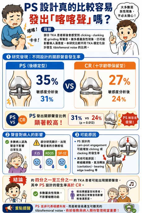 Knee｜PS 設計比較容易發出「喀喀聲」嗎？
