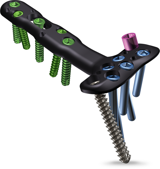 DVR® CROSSLOCK DISTAL RADIUS PLATING SYSTEM