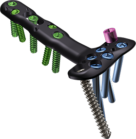 DVR® CROSSLOCK DISTAL RADIUS PLATING SYSTEM
