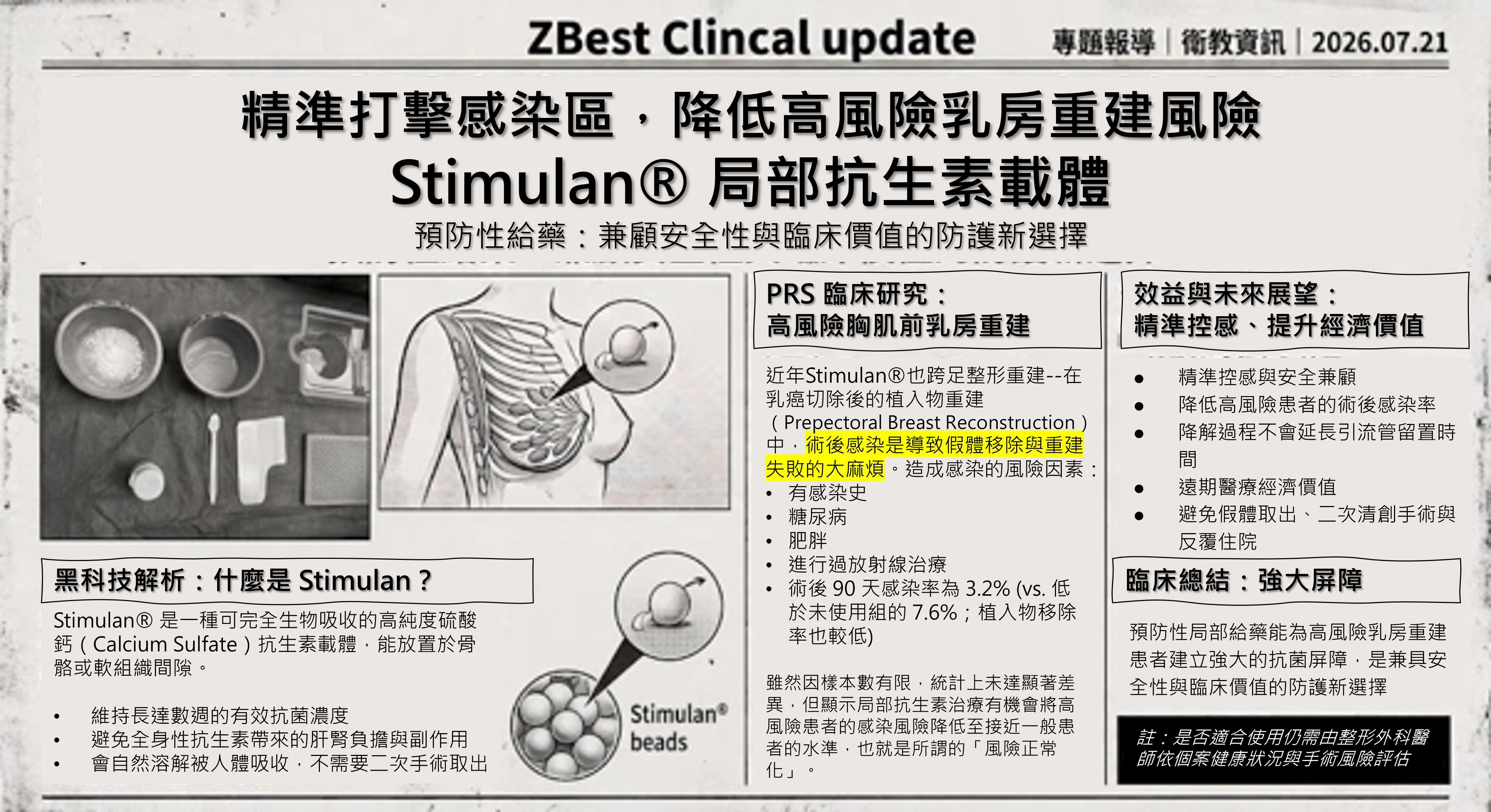 Stimulan® 局部抗生素載體：精準打擊感染區